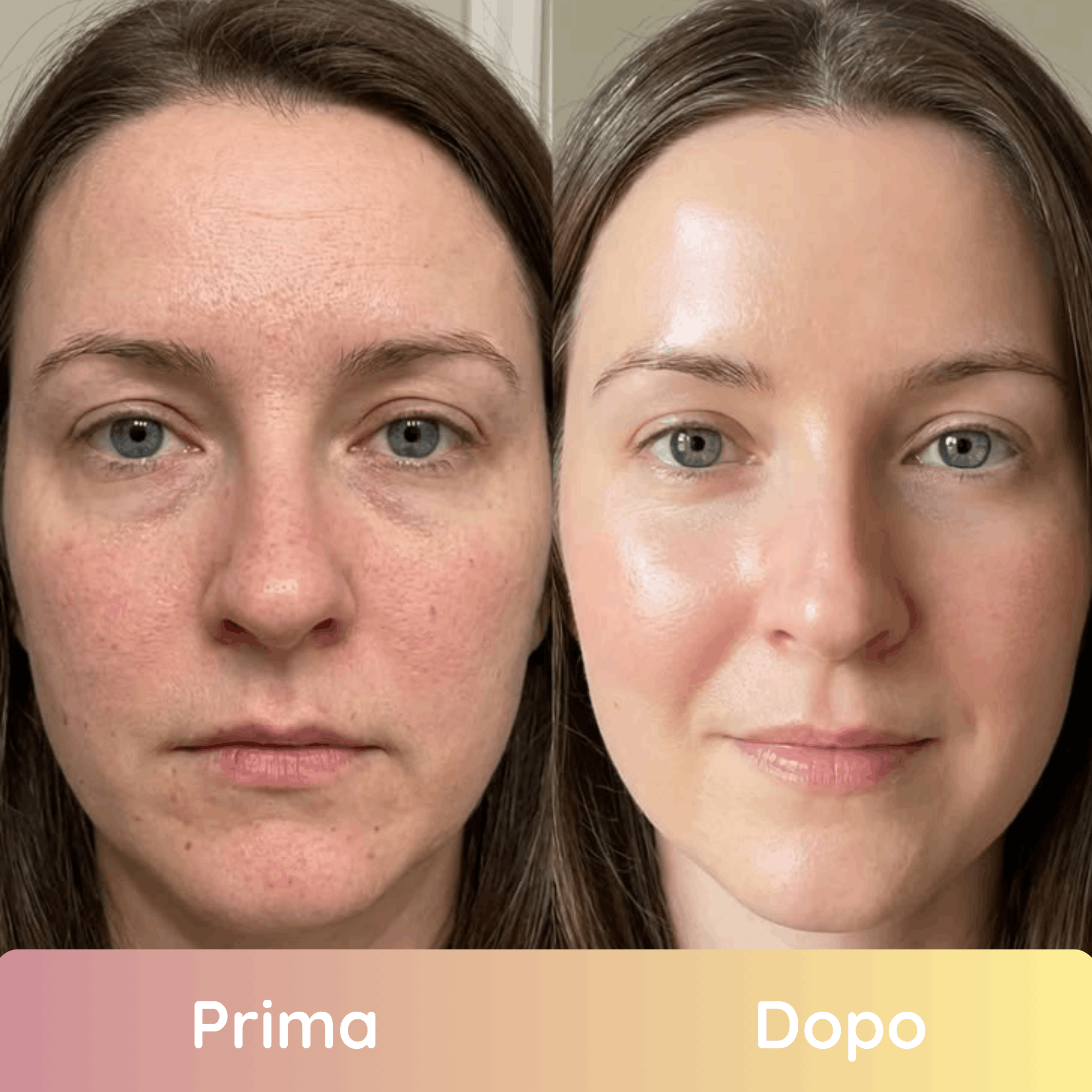 Pads Illuminanti Per Un Viso Uniforme e Giovane in 2 Settimane