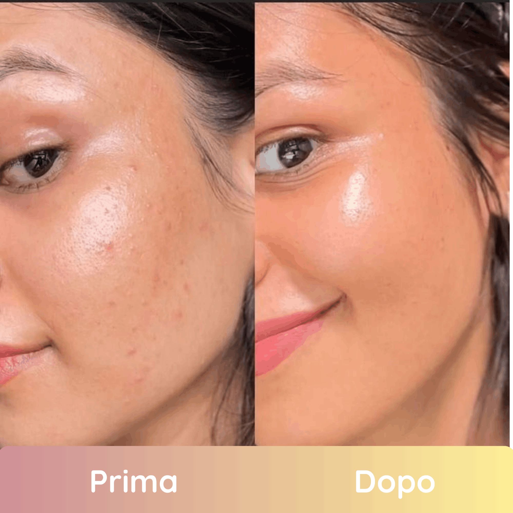 Pads Illuminanti Per Un Viso Uniforme e Giovane in 2 Settimane